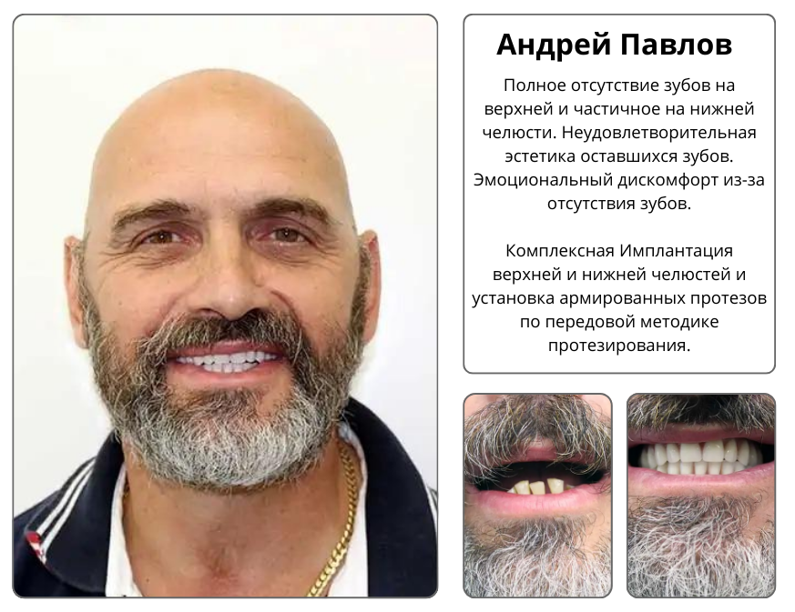 Image title